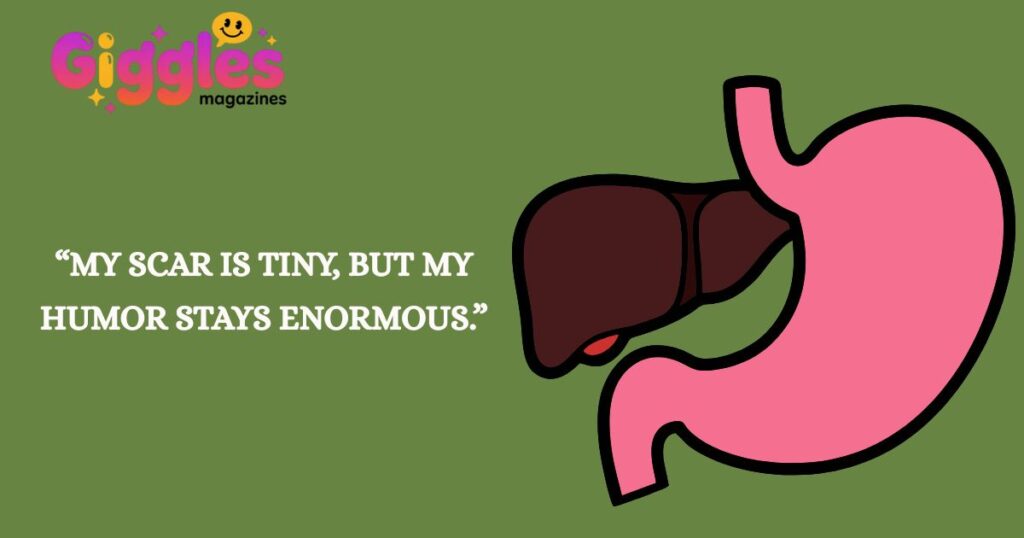 Gallbladder Puns For Friends